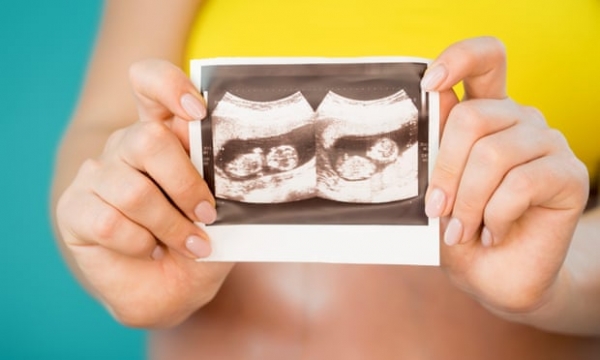 페어허스트씨의 자궁 초음파를 통해 보이는 쌍둥이(사진-영국 가디언지)