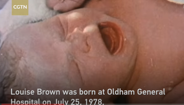 세계 첫 시험관 아기 루이스 브라운이 탄생하는 순간(출처-CGTN 유튜브 영상 캡처)
