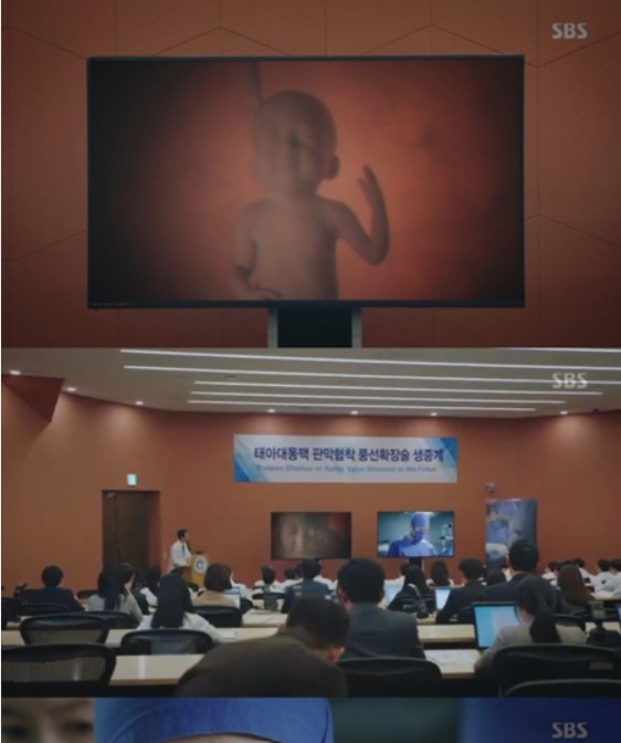 2018년 방송된 SBS 드라마 '흉부외과:심장을 훔친 의사들'에서 20주 태아에게 대동맥판막협착풍선확장술을 시술하는 장면이 나왔다.